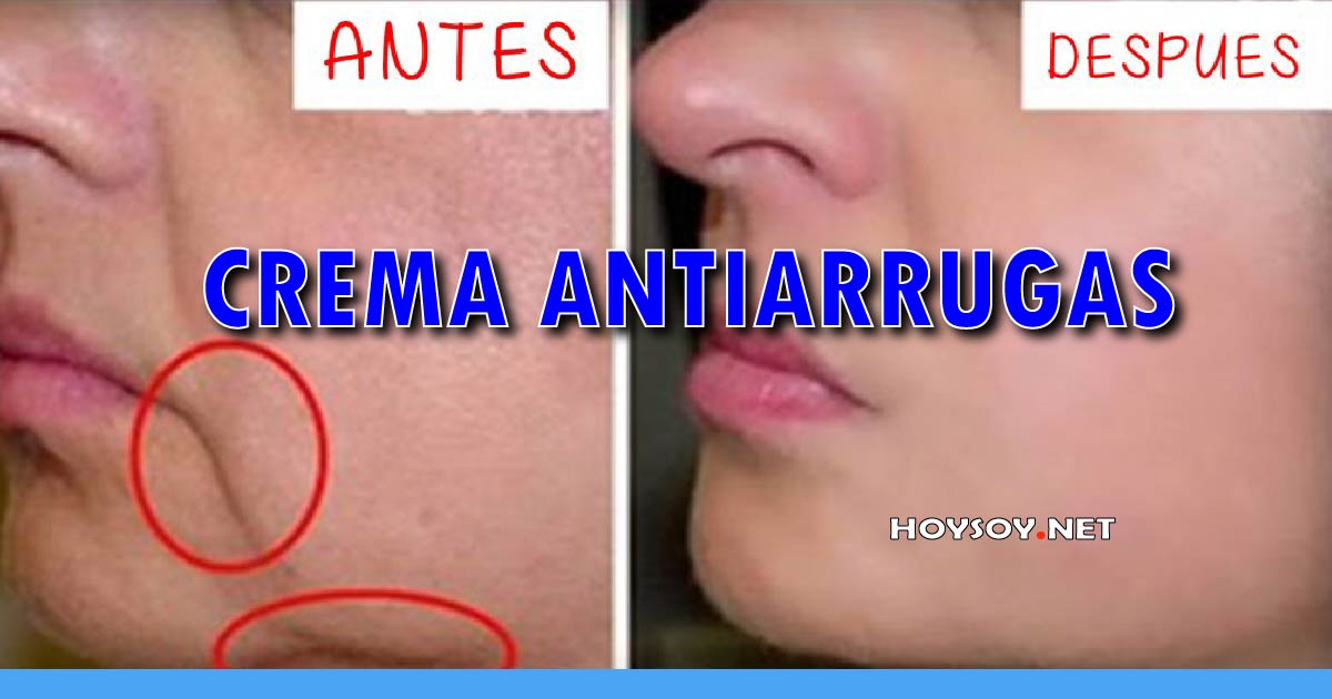 Crema Antiarrugas - REMEDIOS NATURALES