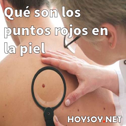 Manchas rojas y puntos rojos en la piel