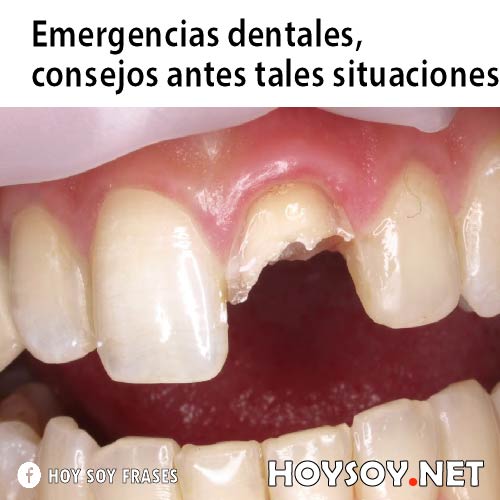 EMERGENCIAS DENTALES