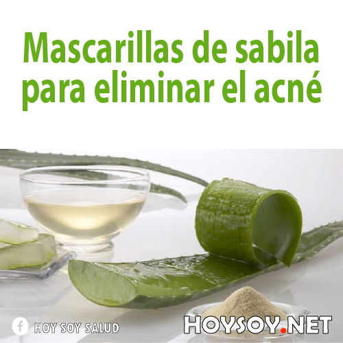 Cremas a base de sábila para el acné 