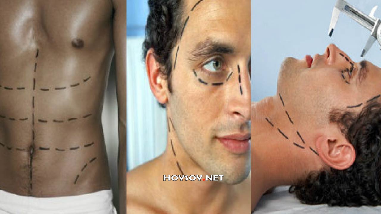 cirugías plásticas masculinas más comunes