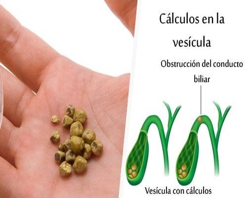 cálculos